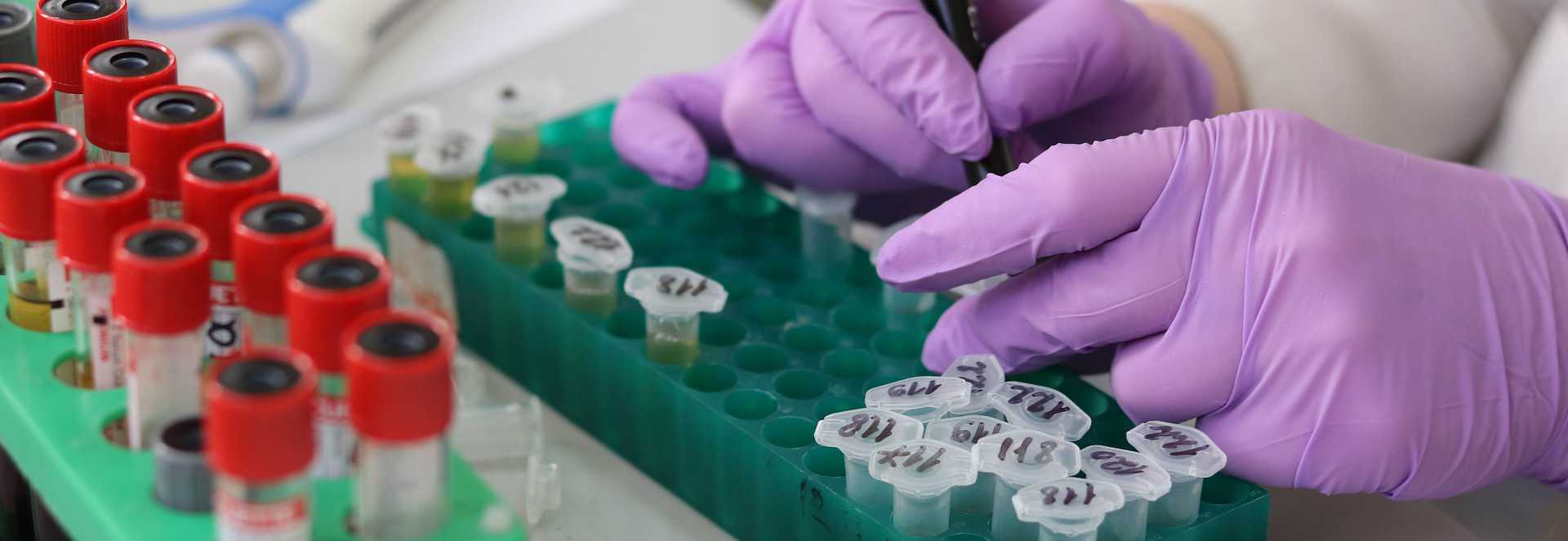 working doing lab work